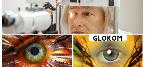 Hangi Durumlar Glokom Riskini Arttırır